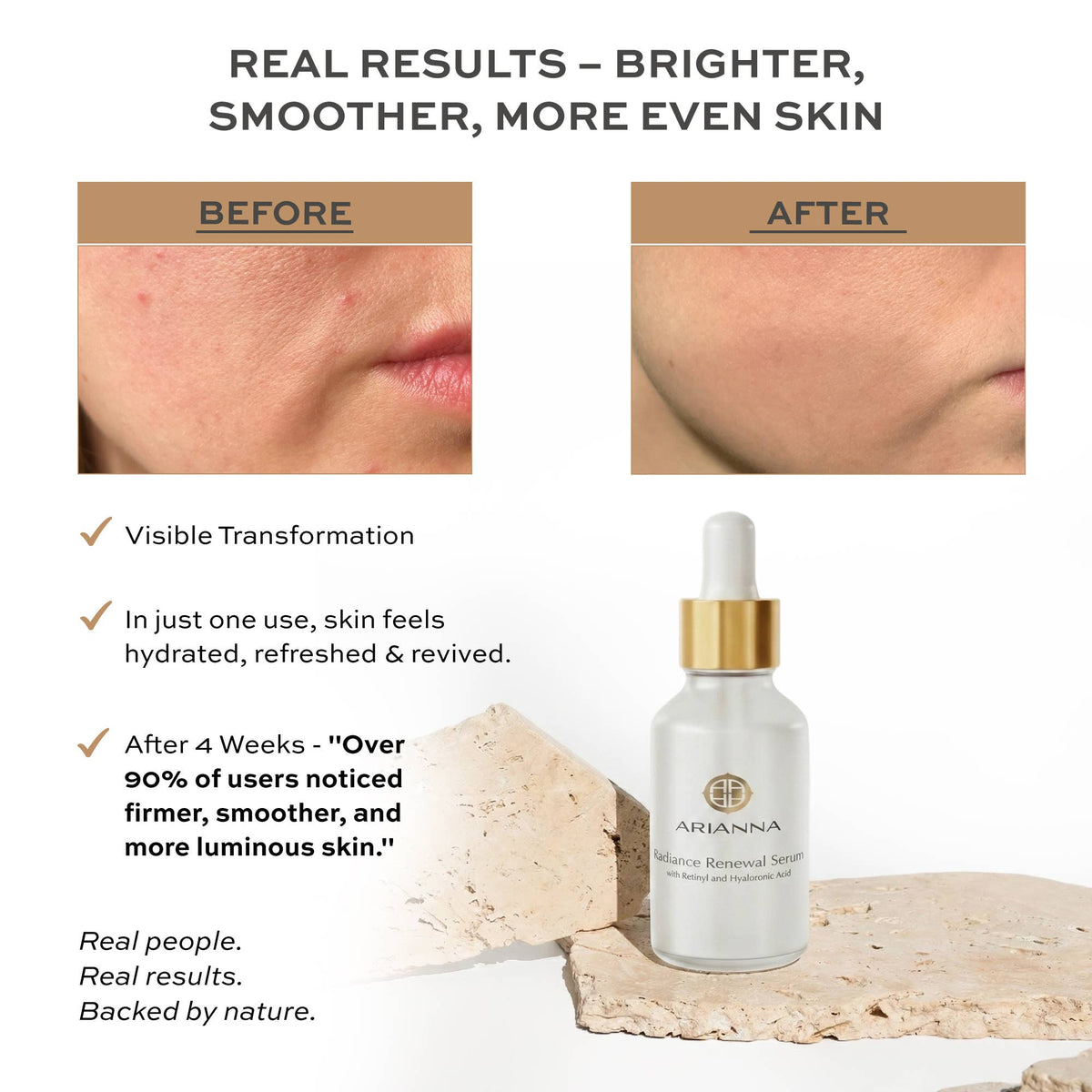 Radiance Renewal Serum