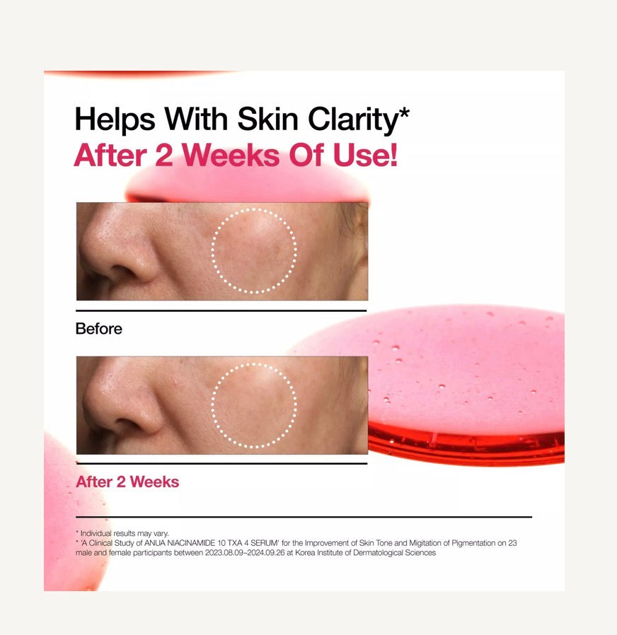 Anua Niacinamide 10% + TXA 4% Serum