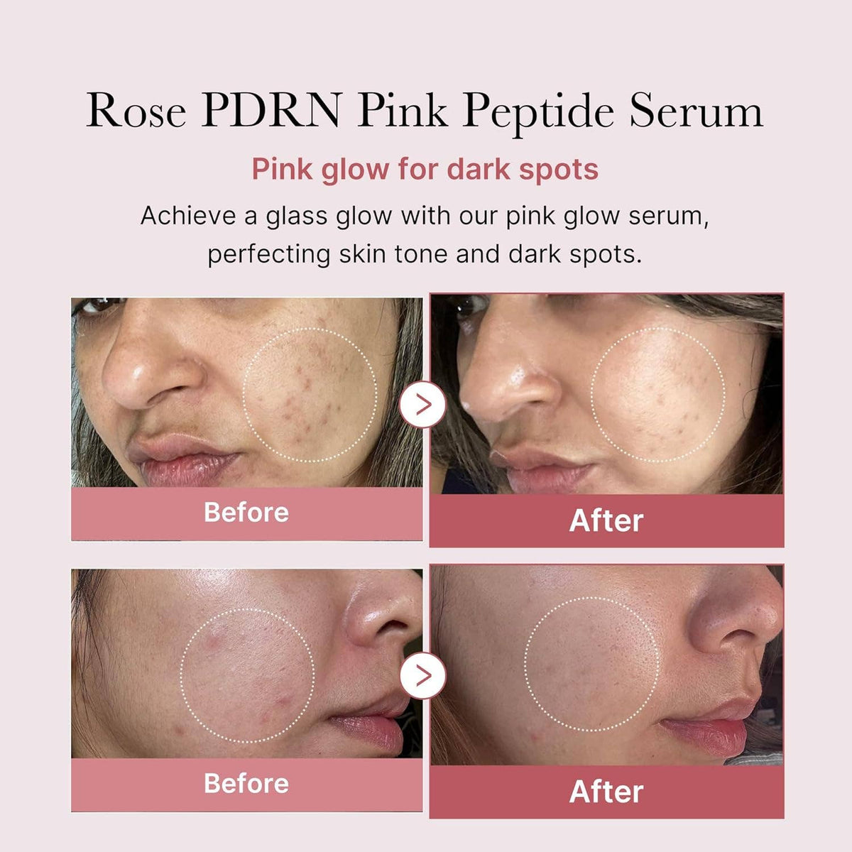 Medicube Salmon Dna Pdrn Pink Peptide Serum 30ml 1.01 Fl.oz.